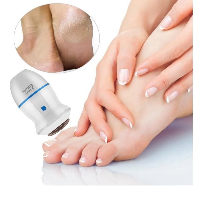 REMOVEDOR DE CALLOS FIND BACK - Economix